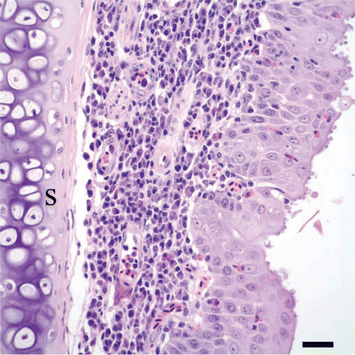 Figure 5.  Nasal septum of a cliff swallow with rhinitis. There is hyperplasia of the nasal mucosal epithelium along the nasal septum (s), as evidenced by piling and layering of epithelial cells, together with scattered intra-epithelial heterophils. Note the infiltrate of lymphocytes and plasma cells in the lamina propria and the cryptosporidial stages along the surfaces of epithelial cells. Bar = 20 µm. Haematoxylin and eosin.