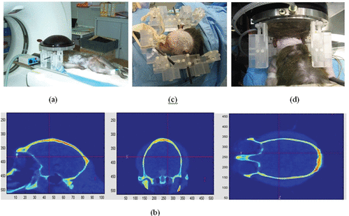 Figure 2. The different steps of the brain HIFU therapy guided by Ctscans: (a) the monkey is imaged into a CT scanner. The head is fixed on a house-made stereotactic frame. (b) Treatment software allows for the selection of the targeted spot. From these data, numerical simulation of the 3D transcranial ultrasonic propagation enables the estimation and correction of skull aberrations for the HIFU treatment. (c) One week after the CT scan exam, the monkey's head is again fixed into the house-made stereotactic frame. (d) The HIFU array is coupled to the monkey's head via the stereotactic frame, thus ensuring the concordance of CT scan reference frames and the HIFU experimental reference frame. The HIFU treatment is then performed using the calculated emission signals.