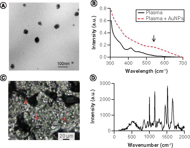 Figure 1. Validation of AuNP formulation and nanoSERS spectra. (A) Representative image using transmission electron microscopy to characterize AuNPs. (B) UV-Vis spectrum of the AuNPs alone or mixed with plasma. An arrow marks a new broad plasmon resonance absorption band at the 560 cm-1 wavelength region. (C) Representative image of 50× magnification of dried mixtures of plasma and AuNPs imaged on Raman microscope. Red arrows mark areas of focus for Raman lasers. (D) Normalized spectra from AuNPs and human plasma.AuNP: Gold nanoparticle.