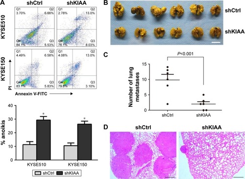 Figure 5 KIAA1522 promotes lung metastasis of KYSE150 cells in NOD/SCID mice.
