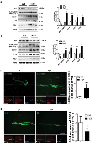 Figure 7. Induction of autophagy and disruption of tight junction proteins in the brains of Tg26 mice and HIV-E subjects.