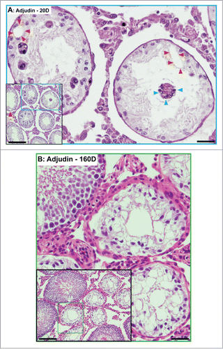 Figure 5. Phenotypes of the seminiferous epithelium in the testes of adult rats by day 20 (A) and day 160 (B) after treatment with a single dose of adjudin (50 mg/kg b.w., by oral gavage). (A) By day 20, tubules are virtually devoid of advanced germ cells. Only Sertoli cells and spermatogonia are found in the seminiferous epithelium. Occasionally, some multinucleate giant cells, such as multinucleate round spermatids are found (blue arrowheads). Vacuolization of seminiferous epithelium, illustrating Sertoli cell focal injury, is noted (red arrowheads). (B) By day 160, signs of rebounding of spermatogenesis is detected. As noted in the inset, at least 4 out of 10 tubules shown display signs of spermatogenesis with notable presence of elongating/elongated spermatids. Micrographs are magnified images from the corresponding boxed area shown in inset. Scale bars, 150 μm and 40 μm in insets.