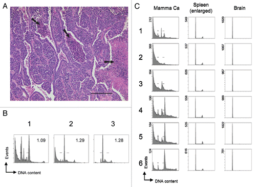 Figure 3 Detection of subtle ploidy alterations in tumor tissue. (A) Histopathology of a heterogenous murine mammary carcinoma specimen derived from transgenic Balb/c WAP-T mice overexpressing SV40 T-Ag. The H&E stained section shows a specimen with mainly undifferentiated areas surrounded by differentiated mammary epithelial cells. Arrows indicate necrotic areas including two centrally located comedo necroses. Scale bar is 200 µm. (B) Cell cycle profiles of various individual mammary carcinoma derived from transgenic Balb/c WAP-T mice. Bars in the histograms indicate the positions of normal 2N and 4N populations, respectively, as previously determined with normal murine splenocytes and mammary gland tissue. Numbers within the histograms indicate the DNA index, determined as the ratio (X-mean of the aberrant distinct peak closest to the normal diploid population)/(X-mean of the normal diploid population). (C) Homo-/heterogeneity of mouse tissues. Individual murine tissues were cut into six sections (1–6) that were processed independently for cell cycle analysis. Bars in the histograms of the mammary carcinoma (Mamma Ca) indicate the positions of normal 2N and 4N populations, respectively, as previously determined with normal murine splenocytes and mammary gland tissue. The Mamma Ca specimen was derived from a transgenic Balb/c WAP-T mouse overexpressing SV40 T-Ag. Spleen and brain specimens were derived from a C57/BL6J p53-/- mouse that had spontaneously developed tumors and displayed a massively enlarged spleen. Tissues were processed and analyzed as in Figure 2A.