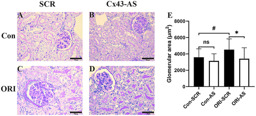 Figure 4 The effect of Cx43 AS on the cross-section area of glomerulus of ORI mice. (A–D) Representative image of kidney section stained with Periodic Acid Schiff (PAS). Standard bar = 50µm. (E) the effect of Cx43-AS on the cross-section area of glomerulus of ORI mice. All data represent mean ± SEM (n=12 per group), and one-way ANOVA with LSD-t multiple comparison test was performed, #P < 0.05, Con-SCR vs ORG-SCR. *P < 0.05, ORG-SCR vs ORG-AS or Con-SCR vs Con-AS.