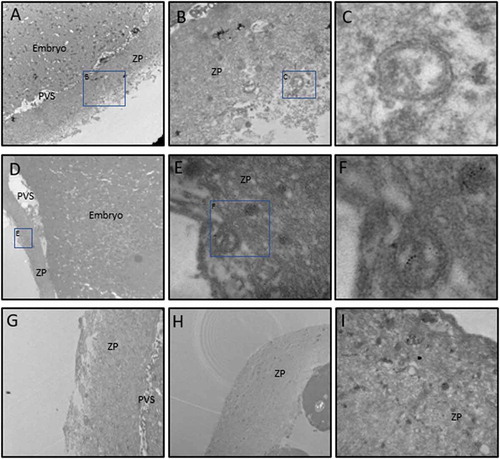 Figure 2. TEM images of embryos of different embryonic stages labeled with anti-CD9 5nm immuno-gold particles. 1 cell zygote (A-C); 3-cell embryo (D-F); 5-cell embryo (G); 8–10 cell embryo (H); blastocyst with no ICM (I). The images show double membrane EVs in the PVS and in the ZP.