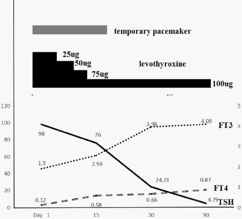 Figure 4 The changes in clinical course and levothyroxine dose, as well as laboratory data including free T3 (FT3), free T4 (FT4), and thyroid-stimulating hormone (TSH) were shown. From day1 to day 3, we kept giving the patient a dose of 25 ug of levothyroxine per day, and then gradually increased to100ug daily from the 14th day, while this patient’s temporary cardiac pacing was discontinued on day 17, which might indicate that thyroxine supplementation may have improved the electrocardiogram abnormality.