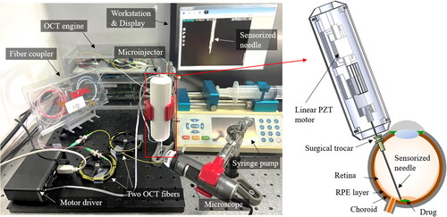 Figure 1. System configuration and the schematic of the handheld microinjection system for precise subretinal injection.