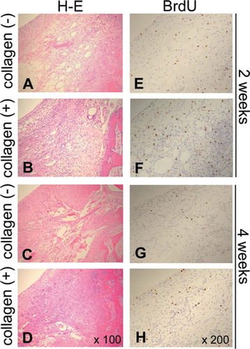 Figure 4. BrdU-positive cells during different phases of cartilage repair. Proliferating cells are identified by BrdU technique: (E), (F), (G), and (H); 200× magnification. Hematoxylin and eosin stained sections of corresponding regions are shown to demonstrate cellularity of the each condition: (A), (B), (C), and (D); 100× magnification.
