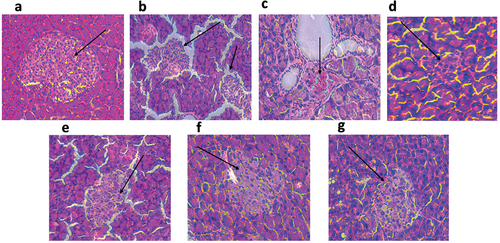 Figure 8. Hematoxylin and eosin-stained histopathological sections of the pancreas at 200X magnification after 21 days of treatment. Black arrows show the islets of Langerhans. (a) Normal rats (NC) maintained a healthy islet; (b) untreated diabetic rats (DC) showed ruptured and dying islets; (c) regenerating islets after 21 days of DCM100 treatment; (d) developing islets with normal round shape after treatment of diabetic rats with DCM200; (e) ruptured islets surviving after treatment with MeOH100; (f) healthy islets reinstated by MeOH200 treatment; (g) healthy islets reinstated by MET200 treatment. NC: negative control; DC: diabetic control; DCM: dichloromethane-methanol (1:1) extract at 100 and 200 mg/kg bw; MeOH: 70% methanol extract at 100 and 200 mg/kg bw; MET200: metformin at 200 mg/kg bw.