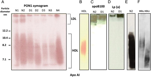 Figure 1. PON1 activity in the LDL and HDL subclasses separated by native gradient electrophoresis gels and western blot detection of LDL apolipoproteins after zymogram. Fig. 1A shows the PON1 zymogram of seven representative Japanese male subjects. N stands for normolipidemic and D for dyslipidemic. LDL and HDL were separated by on 4–12% Tris-Glycine gels as described in the Materials and methods section. PON1 activity in lipoprotein subclasses was determined by the enzymatic detection of PON1 hydrolysis of phenylacetate in situ as described in the Materials and methods section. Fig. 1C–E depicts the western blots conducted after the zymogram depicted in Fig. 1A, as described in the Materials and methods section. ApoB, Lp(a), and ApoA-I were detected on sequential immunoblots using HRP-conjugated antibodies as described in the Materials and methods section. Fig. 1F depicts apoA-I detection in the isolated HDL2 and HDL3. Note the presence of PON 1 activity at the origin in all Japanese subjects and a region compatible with LDL migration well within the gel, which in this example is more apparent for normolipidemics than the dyslipidemic subjects. The presence of this band was found in 5 of 17 dyslipidemic subjects and in 11 of 23 normolipidemics subjects. Note in N2 that apoB100 distributes in higher molecular weight fractions and extends to smaller particles. Note that Lp(a) is present essentially at the origin. VLDL (also containing apoB100) and chylomicrons are excluded from 4–12% gels, they can be ruled out as responsible for PON1 activity found in the particles that penetrate the gel and correspond to the LDL range. Data show a typical experiment out of the three.