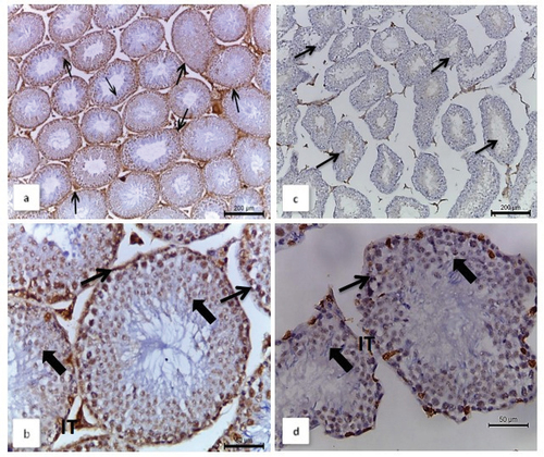 Figure 5. Photomicrographs of testicular sections from male Nile rats illustrating representative immunohistochemical assays for the Wt-1 antibody and immunolocalization of nuclear Wt-1 antibody. In normal males: (a) and (b) exhibit strong brown immunohistochemical stains for Wt-1. A magnified photo in (b) reveals that Wt-1 is primarily localized at the basement membrane (thin arrow), germinal cells (thick arrow), and intertubular space (IT). In quinestrol-treated males, (c) and (d) display a weaker Wt-1 immunoreaction. A magnified view in (d) shows necrotic degenerated seminiferous tubules, with a weak reaction in the destroyed germinal cells (thick arrow) and basement membrane (thin arrow), and nearby no reaction in intertubular spaces (IT).