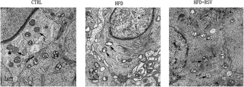 Figure 2. The representive ultrastructures of the testicular tissues were presented. The testicular tissues collected from the CTRL group, HFD group, and HFD+RSV group, were cut into ultrathin slice and observed by transmission electron microscopy. The degeneration could be significantly observed in spermatogenic epithelia of seminiferous tubles in the HFD group, which was improved by the resveratrol treatment. The arrows indicate the mitochondria in spermatogenic cells.