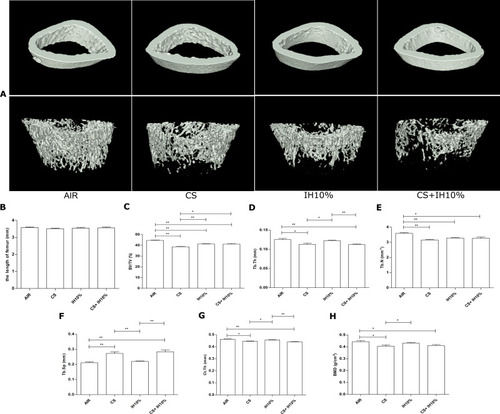 Figure 2 Changes of bone microarchitecture revealed by microcomputed tomography. (A) Three-dimensional reconstruction of cortical bones (upper) and trabecular bones (lower) of the femur. (B) The length of femoral in each group. Quantitative analyses of parameters including: (C) percent bone volume (BV/TV), (D) trabecular thickness (Tb.Th), (E) trabecular number (Tb.N), (F) trabecular separation (Tb.Sp), (G) cortical bone thickness (Ct.Th), (H) bone mineral density (BMD). Data presented as mean ± SD (n=5 per group). * P <0.05; ** P <0.01.