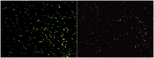 Figure 2. Image of live (green) and dead (red) cells of untreated Sm (left) and treated Sm with 400 mg/L nMST-Au(III) (right) after stained with L/D staining kit at 14 h, taken under fluorescence microscope (100×), and processed by using ImageJ™ image analysis program.