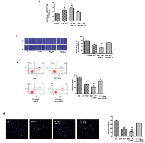 Figure 8. Effects of knock-down of miR126 on MC3T3-E1 cells. (a) The proliferation of MC3T3-E1 cell in different groups. (b) Representative image of cell migration and summarized data on cell migration. (c) Cell apoptosis was measured by flow cytometry. (d) Summarized data on apoptosis rate (%) assessed Hoechst 33258 staining. *p< 0.05, **p< 0.01 vs. SD; ##p< 0.01 vs. EPC-MVs; ++p< 0.01 vs. EPC-MVs-miR126; aap<0.01 vs. EPC-MVs; bbp<0.01 vs. EPC-MVs-anti-miR126.