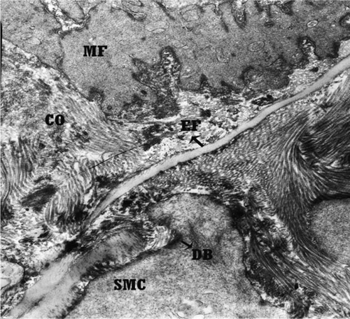 Figure 6.  Transmission electron micrograph of non-transitional zone of right canine external carotid artery with rare and fragmented elastic fibres and more collagen fibres in extracellular space. EF, elastic fibres; COF, collagen fibres; SMC, smooth muscle cell; MF, myofilament; DB, dens bodies. Orcein stain, 11500×, Bar = 0.86 µm.