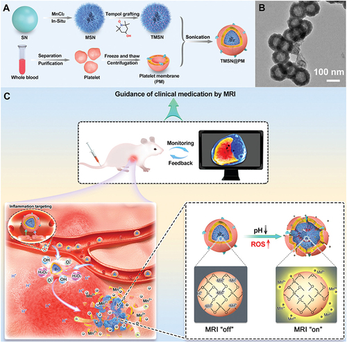 Figure 5 Mn-based nanozymes for ALI alleviation. (A) Schematic illustration of the preparation of TMSN@PM. (B) TEM image of TMSN@PM. (C) Schematic illustration of the in vivo MRI-guided real-time monitoring of the treatment process of inflammatory diseases using TMSN@PM. Reproduced with permission from Li X, Liu Y, Qi X, et al. Sensitive activatable nanoprobes for real-time ratiometric magnetic resonance imaging of reactive oxygen species and ameliorating inflammation in vivo. Adv Mater. 2022;34:e2109004. © 2022 Wiley-VCH GmbH.Citation80