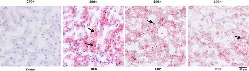 Figure 3. Treatment with delphinidin-3-sambubioside (Dp3-Sam) alleviates lipid deposition in HFD rats. Representative images of hepatic tissue Oil Red O staining of each group, black arrows indicated lipid droplet. Scale bar, 50 µm