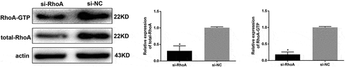 Figure 7. Detection of RhoA silencing effect. The silencing efficiency of si-RhoA was detected by western blot. After RhoA was silenced, the expression of total RhoA and RhoA-GTP were both downregulated. (Data are the mean ± S.D.; *P < 0.05 vs si-NC, n = 3)