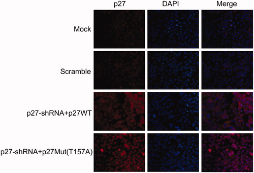 Figure 3. The expression level and subcellular localization of p27 in NPC cells infected with recombinant lentivirus for 72 h.