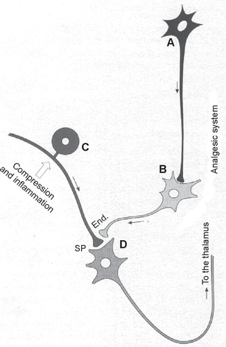 Figure 4 Scheme of the mechanisms for the control of algesic signals. By releasing endorphins (End.), the enkephalinergic interneuron may inhibit the presynaptic connection of a neurocyte (C) of a spinal ganglion, which, under compression of a herniated disc, stimulates the release of substance P (SP). Endorphins can inhibit the transmission of the algesic signal to neuron D (D), hence to the ascending spinal-thalamic fibers. The monoaminergic or serotonergic neuron A (A), as a component of antinociceptive descending fibers, can reinforce the analgesic effect of neuron B (B). Moreover, the localized oxygenation and analgesia are most important because they permit muscle relaxation and vasodilation, thus a reactivation of muscle metabolism, by favoring oxidation of lactate, neutralization of acidosis, increased synthesis of adenosine triphosphate, Ca2+ reuptake, and reabsorption of edema.