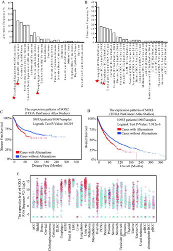 Figure 1. Different expression of SOX2 indicated diverse disease-free survival and overall survival expectations. Expression patterns of SOX2 in kinds of cancer were shown, and through TGCA database and heat map of genes, SOX2 is up-regulating expression in different tumour types, including esophageal, lung and ovarian cancer, especially in esophageal squamous carcinoma (A) and adenocarcinoma (B). The DFS and OS survival curves comparing patients with alteration (red) and without alteration (blue) referring to expression of SOX2 (C and D). Information on 10,953 patients and 10,967 samples were analysed through the TGCA Atlas database. We can know that cases with alternations have a lower disease free survival compared with cases without alternations (p = 0.0219, *p <.05), and cases with alternations have a much shorter overall survival compared with cases without alternations (p = 7.92e-6, *p<.05). Protein Atlas data were screened for SOX2 expression patterns (E). SOX2 upregulates the expression in different tumour types, including esophageal, head and neck, and lung squamous cancer.