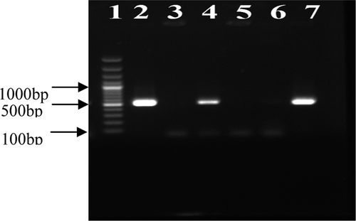 Figure 1. Products of the mecA gene, amplified by PCR.