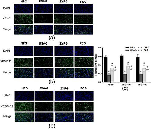Figure 8 Expressions of VEGF, VEGF-R1 and VEGF-R2 protein in vivo verified by IF. (a-c) The positive expressions of VEGF, VEGF-R1 and VEGF-R2 after IF staining. (d) Quantification of fluorescent density of VEGF, VEGF-R1 and VEGF-R2 in different groups. Data are presented as the mean ± SD (n=3). *P<0.05 versus normal pregnancy. #P<0.05 versus RSA.
