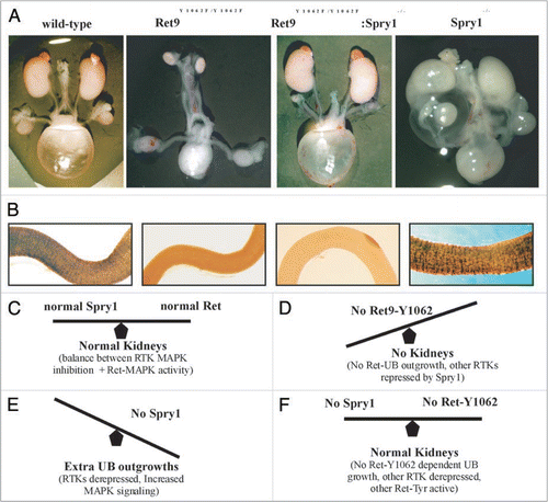 Figure 6 Genetic interactions between Ret and Sprouty1 (Spry1) are specific to kidney. (A) Loss of Sprouty1 rescues renal defects found in animals expressing Ret9 Y1062F. Whole mount of genito-urinary tracts from newborn mice of the indicated genotypes. Note that compared to individual Ret9-Y1062F or Spry1-/-, the double Ret9-Y1062F:Spry1-null mice have essentially normal appearing kidneys and ureters. Thus, both the agenesis and complex CAKUT phenotypes are rescued when these mutations are in the same background. (B) Lack of effect of Spry1 deficiency on the enteric innervation defects observed in RetRET9(Y1062F/Y1062F) mice, as revealed by whole mount acetylcholine esterase activity of digestive tracts from newborn mice. Thus, in the enteric nervous system Spry1 does not interact with Ret as it is not able to rescue Hirschsprung disease phenotype in Ret-Y1062F mutants. Adapted and modified from Rozen et al.Citation51 with permission. (C–F) Model summarizing Ret-Spry1 interactions in the kidney. In normal situations, Ret-activated cascades and Spry1 inhibition on Ret and other RTKs is in correct balance leading to normal kidneys (C). In absence of Ret-Y1062 signals, the main residue that determines uB outgrowth, kidneys don't develop; other RTKs cannot compensate as Spry1 is still inhibiting them (D). Without Spry1, Ret-MAPK inhibition is gone leading to perhaps enhanced Ret-Y1062-MAPK signaling, as is also from other RTKs that may have the potential to influence UB growth, thus leading to multiple ectopic UBs from the WD (E). In the absence of both Spry1 and Ret-Y1062, normal kidneys are observed because, other RTKs or other Ret-Tyr can potentially activate UB growth mechanisms in distal WD as repression from Spry1 is absent; ectopic UBs are not seen since RetY-1062 is the major signaling mechanism for UB growth in anterior WD.