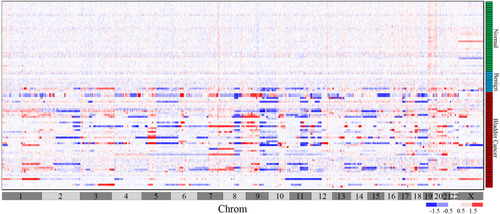 Figure 3 Chromosome copy number alterations heatmap of 100 samples of urine sediments.