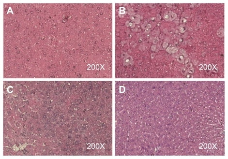 Figure 3 Liver tissue sections of A) control group, B) chloroform group, C) microscale SHXXT decoction group, and D) nanoscale SHXXT decoction group stained with hematoxylin and eosin.Abbreviation: SHXXT, San-Huang-Xie-Xin-Tang.