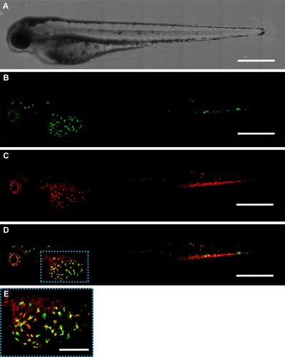 Figure 3 Distribution of zebrafish macrophages and gelatin nanospheres at 24 hours after intravenous injection of gelatin nanospheres into a 3-day-old zebrafish larva. (A) Bright field image; (B) green fluorescent macrophages; (C) red fluorescent gelatin nanospheres; (D) merged image of (B) and (C) with co-localization of gelatin nanospheres and macrophages depicted in yellow. The majority of the observed macrophages co-localized with gelatin nanospheres in the area surrounding the yolk sac of the larva (blue dashed box in D). Scale bars represent 500 μm. (E) Magnification of the boxed area in (D). Scale bar represents 200 μm.