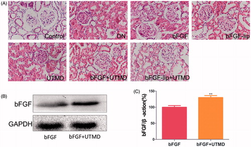 Figure 3. Effects of bFGF-lip + UTMD on renal histopathological morphology and the content of bFGF in kidney combined with UTMD. (A) Haematoxylin–eosin staining of kidney; (B) Western blot analysis of bFGF; (C) quantitative analyses of bFGF. N = 6 per group. Data are expressed as the mean ± SD. *p < .05, **p < .01 and ***p < .001 versus the bFGF group.