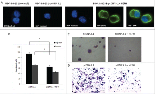 Figure 5. Restoration of NEFH expression in MDA-MB-231 breast cancer cells slows tumor progression. (A) The cellular localization of NEFH protein in MDA-MB-231 cells transiently transfected with pcDNA3.1 and pcDNA3.1-NEFH was determined by immunofluorescence with anti-NEFH (FITC). Nuclei were visualized by staining with DAPI. The NEFH protein was not expressed in MDA-MB-231 cells transfected with pcDNA3.1 and just the nuclei was visualized in these cells. MDA-MB-231 wild type cells were also stained for NEFH to determine endogenous levels of NEFH expression and the specificity of the NEFH antibody and as NEFH protein was not expressed in MDA-MB-231 wild type cells just the nuclei was visualized in these cells. (B) Invasion and migration assays in MDA-MB-231 cells transfected with pcDNA3.1 (empty vector) or pcDNA3.1-NEFH. Twenty-four hours post transfection, cells were harvested, suspended in serum-free media and added either directly to the top chamber of transwell plates (migration assay) or to the top chamber of transwell plates that were layered with 2 mg/ml matrigel (invasion assay). Growth media containing 10% serum was added to the bottom chamber and cells were allowed to migrate or invade for 24 and 48 hours respectively. Cells attached to the membrane were fixed and subsequently stained with giemsa or crystal violet. For quantification of migrated or invaded cells X fields per well were randomly selected and counted. Data presented are the mean of 2 independent experiments § SEM. Group comparisons were carried out using Student t test, P < 0.05. (C) Representative images of the invasion assay in MDA-MB-231 cells transfected with either pcDNA3.1 (empty vector) or pcDNA3.1-NEFH. (D) Representative images of the migration assay in MDA-MB-231 cells transfected with pcDNA3.1 (empty vector) or pcDNA3.1-NEFH.