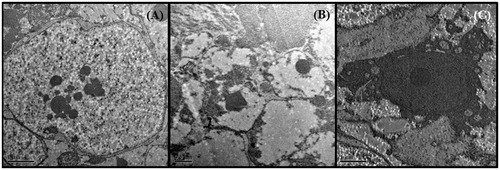 Figure 6. TEM of the nucleus of R tetragona: (A) control showing nucleus with distinct nuclear membrane and nucleolus and grannular cytoplasm; (B) treated worms with C. viscosum showing distinct nuclear membrane but with electron lucent matrix and distinct nucleolus; (C) PZQ-treated worms showing nucleus with dense cytoplasm. All scale bars 1 μm.