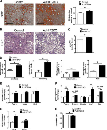 FIG 7 Obese AdHIF2KO mice develop enhanced hepatosteatosis. Mice were sacrificed after 24 weeks on an HFD. (A) Representative pictures of oil red O (ORO) staining of livers from control and AdHIF2KO mice and quantification (n = 5/group). Steatosis (ORO staining) of control mice was set as 1. Scale bar is 200 μm. (B) Representative images (H&E staining) of obese control and AdHIF2KO mouse livers. Scale bars are 200 μm. (C) Triglyceride content was determined in livers from control and AdHIF2KO mice fed for 24 weeks with an HFD (n = 6 or 7). (D) Histological scoring for steatosis, hepatocellular ballooning, lobular inflammation and NAFLD activity score (NAS) of livers from obese control and AdHIF2KO mice (n = 5). (E to G) Gene expression analysis for lipolytic (E) and lipogenic markers (F), as well as transporters for FFA (Cd36) and glucose (Glut2) (G) in livers from obese control and AdHIF2KO mice (n = 6 or 7). Gene expression of control mice was set as 1. (H) Serum free fatty acids (FFA) from control and AdHIF2KO mice fed an HFD (n = 8 to 12). Data are expressed as means ± SEMs. *, P < 0.05.