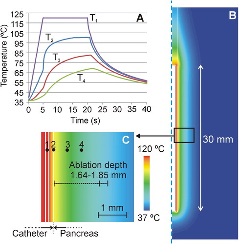 Figure 6. Computer results. (A) Temperature progress at several points of the model (1: inner conductors; 2: surface of the catheter; 3: at 0.45 mm from the surface; 4: at 1 mm from the surface). (B) Temperature distributions at 20 s in the catheter and pancreas. (C) Detail of the temperature in the proximity of the catheter, showing the position of the points where the temperature is plotted in Panel (A).