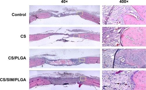 Figure 3 Histological specimens from calvarial defects 8 weeks after implantation of bone graft substitutes with hematoxylin-eosin staining.Note: Calvarial defects implanted without bone graft substitutes were used as controls.Abbreviations: CS, calcium sulfate; SIM, simvastatin; PLGA, poly(lactic-co-glycolic acid) microspheres.