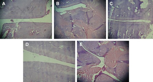 Figure 6 Photomicrographs of histological section of ankle joint in the respective groups.Notes: (A) Group I – normal joint, (B) group II – control; (C) group III – treatment with standard marketed gel, (D) group IV – treatment with CR-NEG; and (E) group V – treatment with CR-CG. Images taken on 10× magnification.Abbreviations: CR-NEG, curcumin nanoemulsion gel; CR-CG, curcumin crude gel.