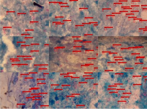 Figure 9. Results of the original YOLOv4 test for selected Mycobacterium tuberculosis images.