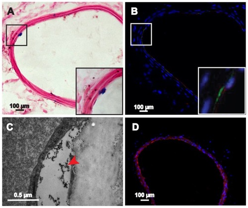 Figure 8 Histological examination of the injured carotid artery 7 days after transplantation. (A) Blue-stained particles were observed in the lesion area (magnified view of the square area in [A]). (B) GFP-ADSCs homing into the injured lesions and differentiated into endothelium were visualized using fluorescence microscopy of GFP and CD31 (red) after nuclear staining with DAPI (magnified view of the square area in [B]). (C) TEM results indicate that the iron particles accumulated in the lesion area. (D) Macrophage mark F4/80 (red) could be detected at 7 days.Note: Scale bar A, B, and D measure 100 μm; C measures 0.5 μm.Abbreviations: DAPI, 4′, 6-diamidino-2-phenylindole; GFP-ADSCs, green fluorescent protein adipose-derived stem cells; TEM, transmission electron microscopy.
