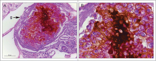 Figure 3. The cellular and humoral response to infection with P. brasiliensis after 3 days. Granuloma structure, amplification 400X (A); melanization and encapsulation process, amplification 1000x. (B). Similar structures were observed during P. lutzii infection. Structure annotated: (g) granuloma-like structure.