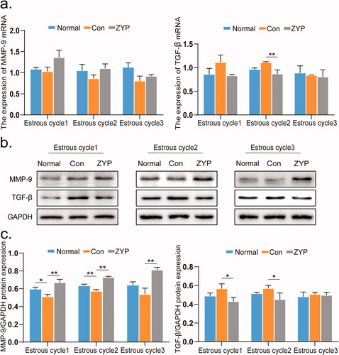 Figure 5. The mRNA and protein expression levels of MMP-9 and TGF-β of rat endometrium in three groups. (*p < 0.05, **p < 0.01) (a) The mRNA expression levels of MMP-9 and TGF-β in rat endometrium. (b) The representative images of western blot for MMP-9 and TGF-β in rat endometrium. (c) The protein expression level of MMP-9 and TGF-β in rat endometrium. Con: control; ZYP: Zishen Yutai Pill; TGF-β: transforming growth factor; MMP-9: matrix metalloproteinase 9.