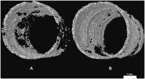 Figure 9 Three-dimensional images showing regeneration of microstructures about 0.5 mm in thickness bonding to PEEK (A) and n-TiO2/PEEK (B) implants in the marrow.Abbreviation: PEEK, poly(ether-ether-ketone).