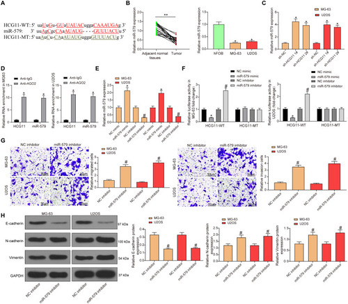 Figure 3 LncRNA HCG11 negatively regulates miR-579. (A) potential binding sequence of miR-579 and lncRNA HCG11. (B) miR-579 expression in OS and adjacent normal tissues (paired t-test, **p < 0.01 vs adjacent normal tissues), human osteoblastic cell line (hFOB) and OS cells (MG-63 and U2OS) (the data were analyzed by one-way ANOVA, *p < 0.05 vs hFOB cells) detected by RT-qPCR. (C) miR-579 expression in MG-63 and U2OS cells transfected with sh-HCG11 1,2# detected by RT-qPCR (the data were analyzed by one-way ANOVA, *p < 0.05 vs sh-NC treatment). (D) the binding relationship between HCG11 and miR-579 verified by RIP assays (the data were analyzed by two-way ANOVA, *p < 0.05 vs sh-NC treatment). (E) miR-579 expression in MG-63 and U2OS cells transfected with miR-579 inhibitor/mimic detected by RT-qPCR (the data were analyzed by one-way ANOVA, *p < 0.05 vs NC mimic, #p < 0.05 vs NC inhibitor). (F) luciferase activity in MG-63 and U2OS cells co-transfected with the constructed luciferase reporter plasmids (HCG11-WT or HCG11-MT) and NC or miR-579 mimic/inhibitor determined by dual-luciferase reporter assay (the data were analyzed by two-way ANOVA, *p < 0.05 vs NC mimic, #p < 0.05 vs NC inhibitor). (G) cell migration and invasion in MG-63 and U2OS cells transfected with miR-579 inhibitor detected by Transwell assay (the data were analyzed by one-way ANOVA, #p < 0.05). (H) expression of E-cadherin, N-cadherin and Vimentin in MG-63 and U2OS cells transfected with miR-579 inhibitor detected by Western blot analysis (the data were analyzed by one-way ANOVA, #p < 0.05). All data were generated from triplicate independent experiments and presented as the mean ± SD.