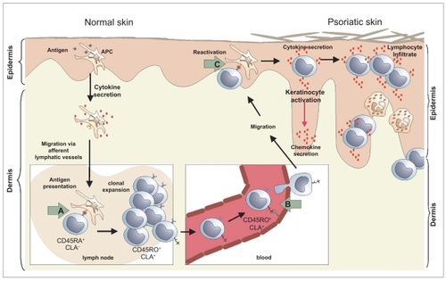 Figure 1 Mode of action of efalizumab in psoriasis: According to a widely accepted working hypothesis, antigen-presenting dendritic cells of the epidermis transport yet unknown antigens to regional lymph nodes and present them to naïve T-cells. These respond by activation, proliferation, and maturation into effector T-cells, which patrol the body and leave circulation at the site of antigen contact. Subsequently, these cells migrate toward the epidermis and upon re-activation, release effector molecules, namely pro-inflammatory cytokines. Efalizumab interferes with this process at the LFA-1 dependent stages, namely activation of T-cells in lymph nodes (A), extravazation of circulating T-cells in inflammatory skin (B), and T-cell re-activation in the skin (C).