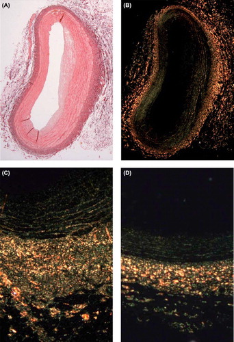 Figure 2. Cross section of the right coronary artery stained with picrosirius red (red color) for collagen density analysis. A. without polarization, B. with polarization. A view of a sham-treated artery wall (C) is compared to a TTA-treated artery wall (D).