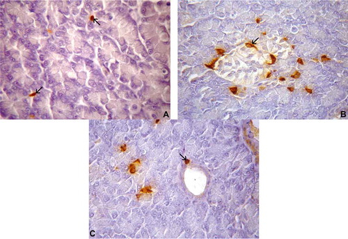 Figure 5. (A–C). Photomicrographs of somatostatin-immunoreactive (IR) cells in the pancreas of Tropidurus torquatus. A, The presence of somatostatin-IR cells between exocrine acinar cells can be observed (arrow; 870×). B, Note the islet-like regions; spindle-shaped somatostatin-IR cells were found in the peripheral portion (arrow; 870×). C, View of spherical somatostatin-IR cells in the parenchyma and on the exocrine ducts (arrow; 1040×).