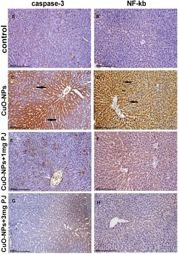 Figure 6 Immunohistochemical expression of caspase-3 and NF-ĸB protein in the liver sections in different groups showing (A and B) mild to negative Caspase-3 and NF-ĸB protein expression in control negative group. (C and D) Strong positive caspase-3 and extensive nuclear translocation of NF-ĸB protein within hepatocytes in the group intoxicated with CuO-NPs. (E and F) Moderate positive caspase-3 and NF-ĸB protein expression in the group pretreated with 1 mL/kg bwt PJ. (G and H) Mild to negative caspase-3 and NF-ĸB protein expression in the group treated with 3 mL/kg bwt PJ.