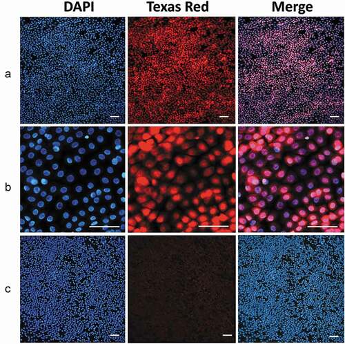 Figure 6. Immunofluorescence detection of ATF4.